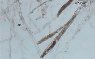 Saprolegnia hyphae